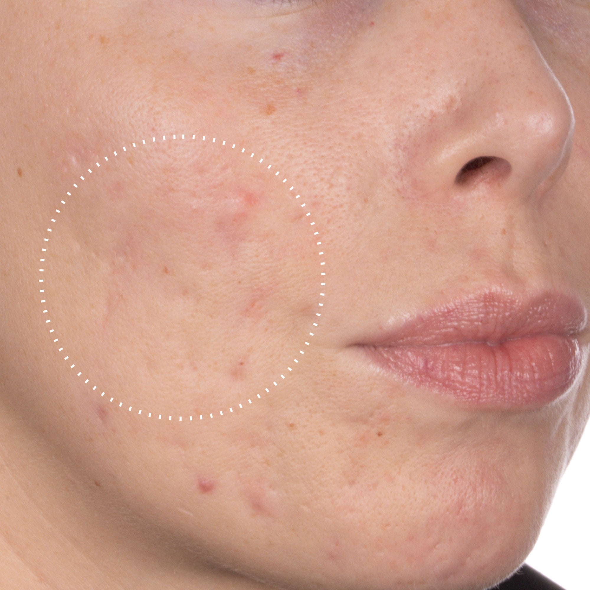 Niacinamide: Ingredient Guide