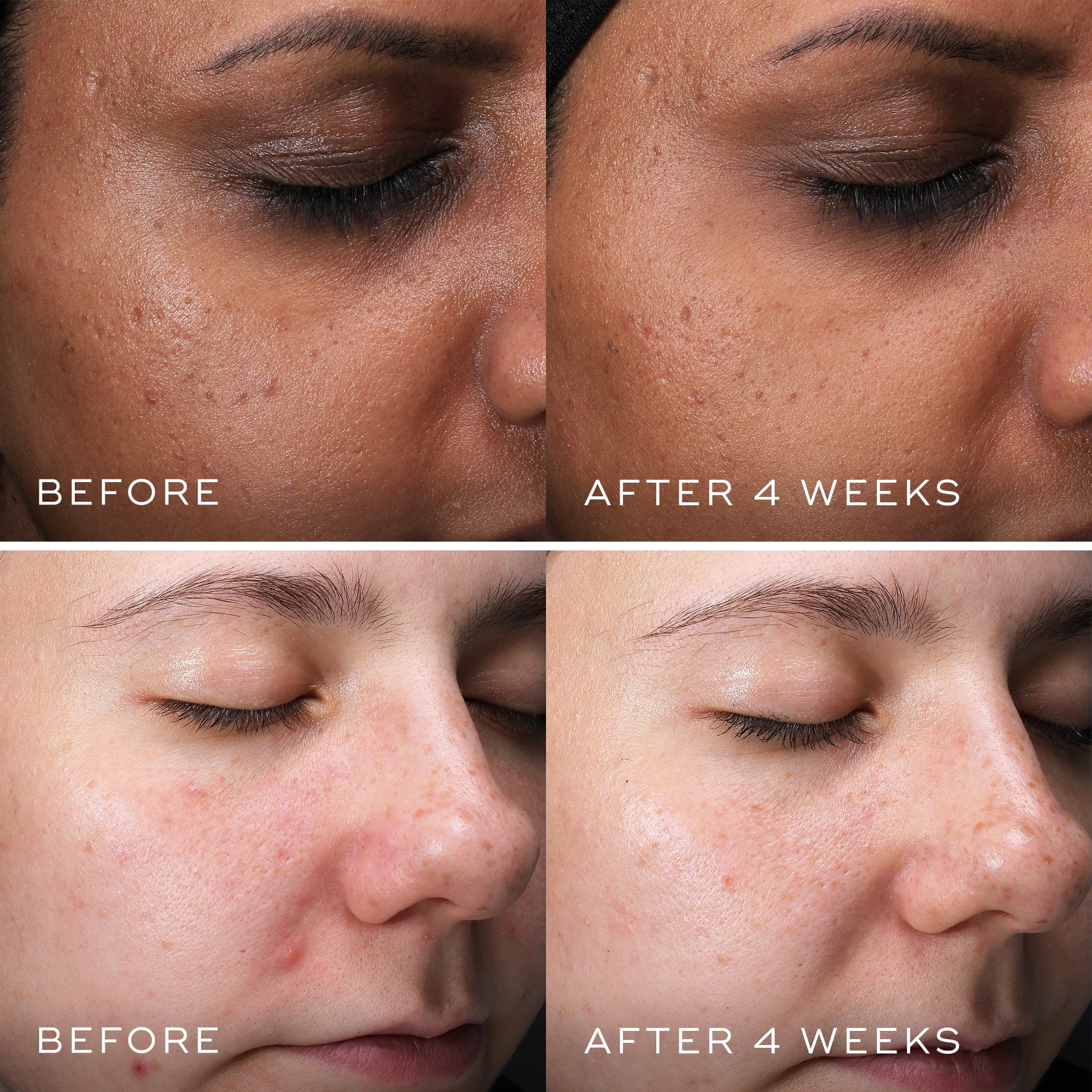 Clarity Peptides by Medik8. A 10% Niacinamide-Infused Peptide Serum.